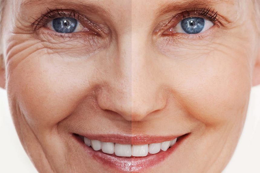 Sagging facial skin treatment with mesotherapy